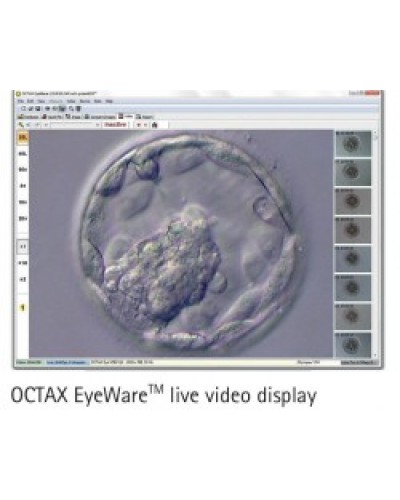OCTAX EyeWare™ imaging software